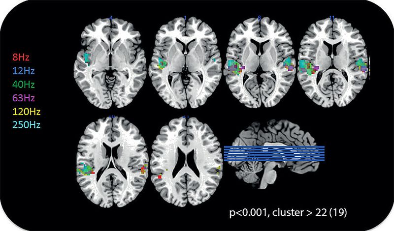 Aktivität im Gehirn im Gebiet des auditiven Cortex bei Stimulation durch niederfrequenten Schall und Infraschall. (Bild: Max-Planck-Institut für Bildungsforschung)