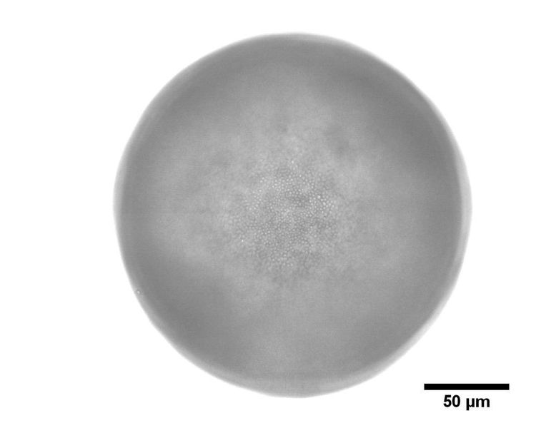 Abb. 5: Emulsion Wasser in Öl - 61,8 Prozent bedeckt ( Gruppe Vermant, ETH Zürich)