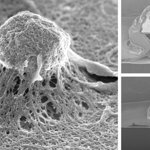 Von der Zellmembran umhüllte Elektroden unter dem Rasterlekektronenmikroskop.